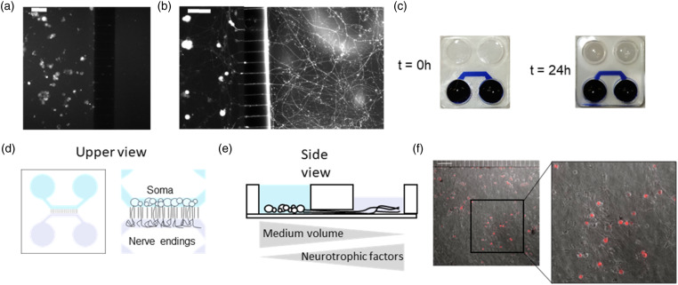 Compartmentalized primary cultures of dorsal root ganglion neurons to model peripheral pathophysiological conditions.