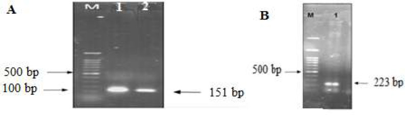 Design and construction of a chimeric peptide, MeICT/IMe-AGAP, from two anti-cancer toxins of Iranian <i>Mesobuthus eupeus</i> scorpion.