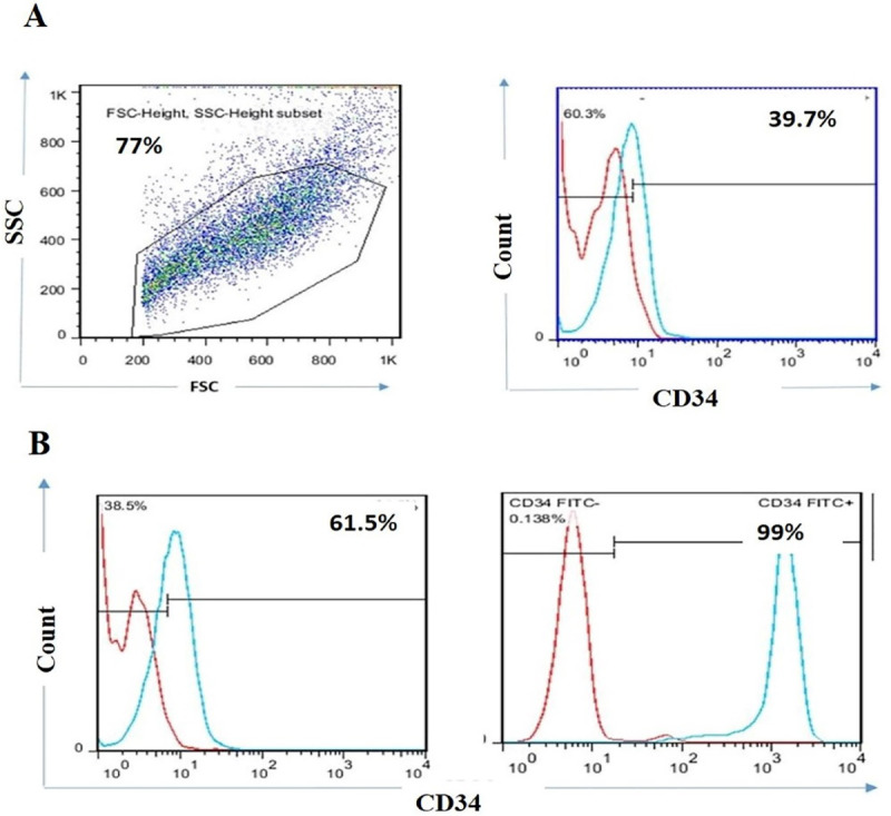 The Effect of Telomerase Inhibition on NK Cell Activity in Acute Myeloid Leukemia.