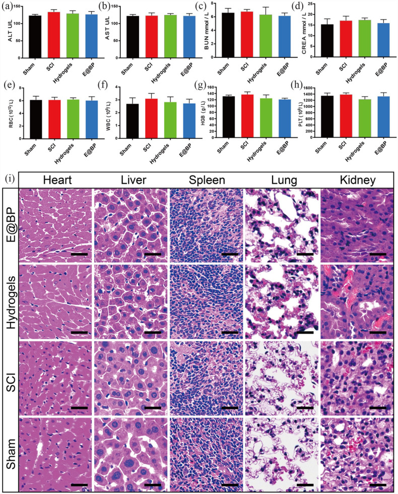 Modified black phosphorus quantum dots promotes spinal cord injury repair by targeting the AKT signaling pathway.