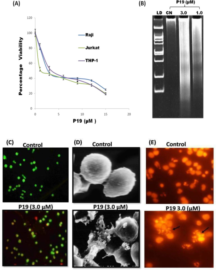 P19 a Parthenin Analog Induces Cell Lineage Dependent Apoptotic and Immunomodulatory Signaling in Acute Lymphoid Leukemia Cells.