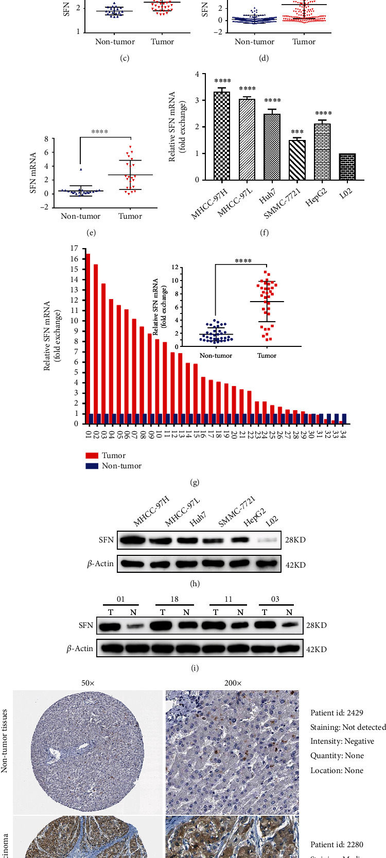 Stratifin Promotes Hepatocellular Carcinoma Progression by Modulating the Wnt/<i>β</i>-Catenin Pathway.