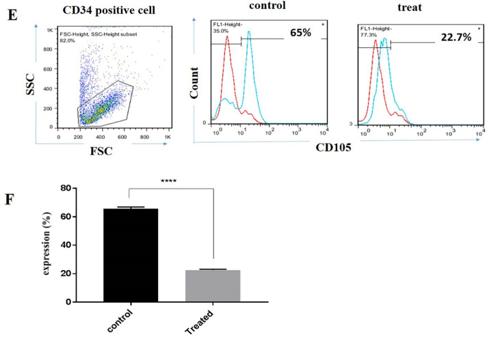 The Effect of Telomerase Inhibition on NK Cell Activity in Acute Myeloid Leukemia.