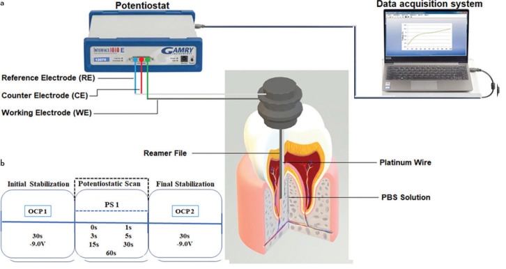 Advanced Electrochemical Reamer (EC-Reamer) for Root Canal Treatment.