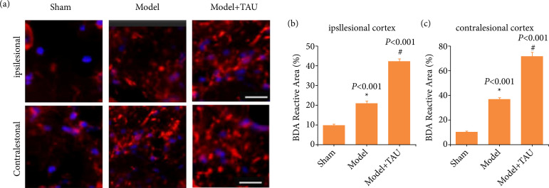 Taurine promotes axonal sprouting via Shh-mediated mitochondrial improvement in stroke.