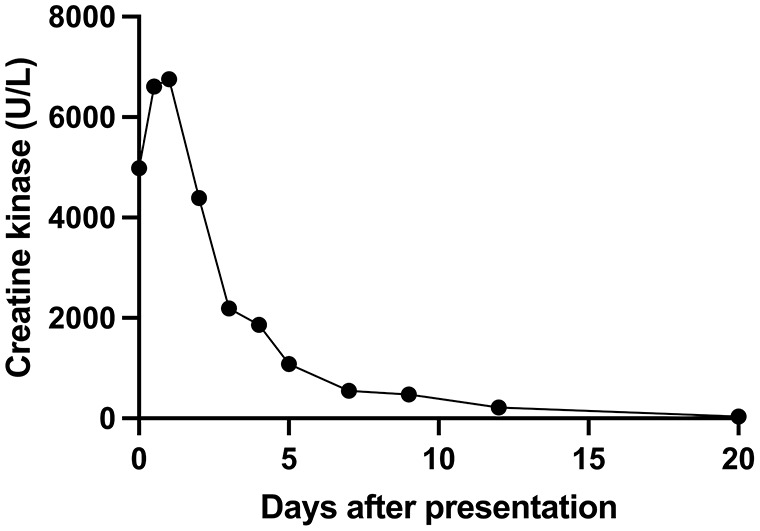 Gemcitabine-Induced Myositis in a Luminal B Breast Cancer patient: A Case Report.