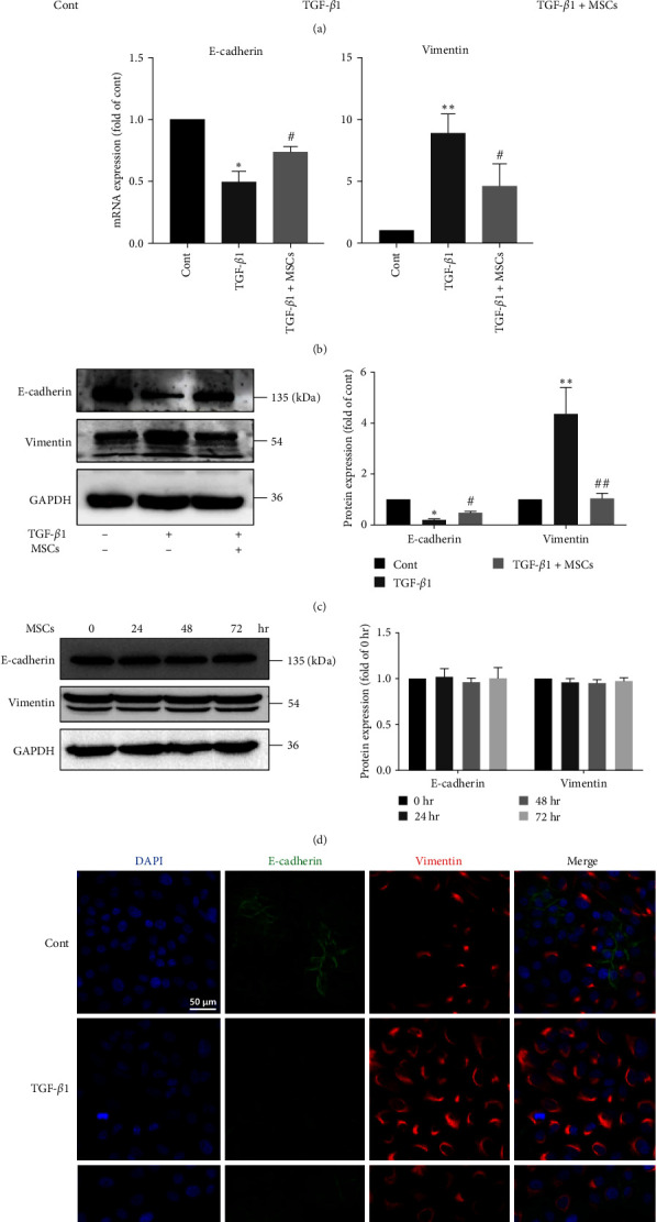 Mesenchymal Stem Cells Inhibit Epithelial-to-Mesenchymal Transition by Modulating the IRE1<i>α</i> Branch of the Endoplasmic Reticulum Stress Response.