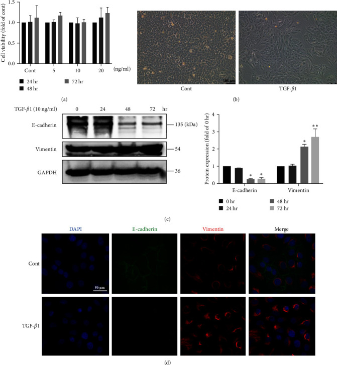 Mesenchymal Stem Cells Inhibit Epithelial-to-Mesenchymal Transition by Modulating the IRE1<i>α</i> Branch of the Endoplasmic Reticulum Stress Response.