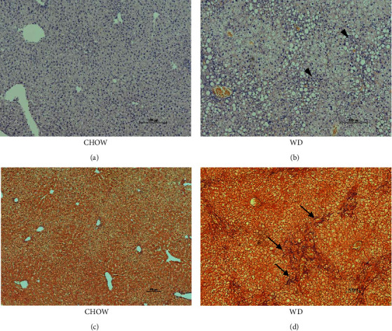 Western Diet Decreases Hepatic Drug Metabolism in Male LDLr<sup>-/-</sup>ApoB<sup>100/100</sup> Mice.