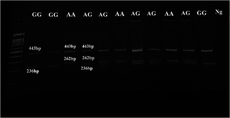 Association of ANRIL Gene Single-Nucleotide Polymorphisms With Allergic Rhinitis in Kurdish Population From Kermanshah, Iran.