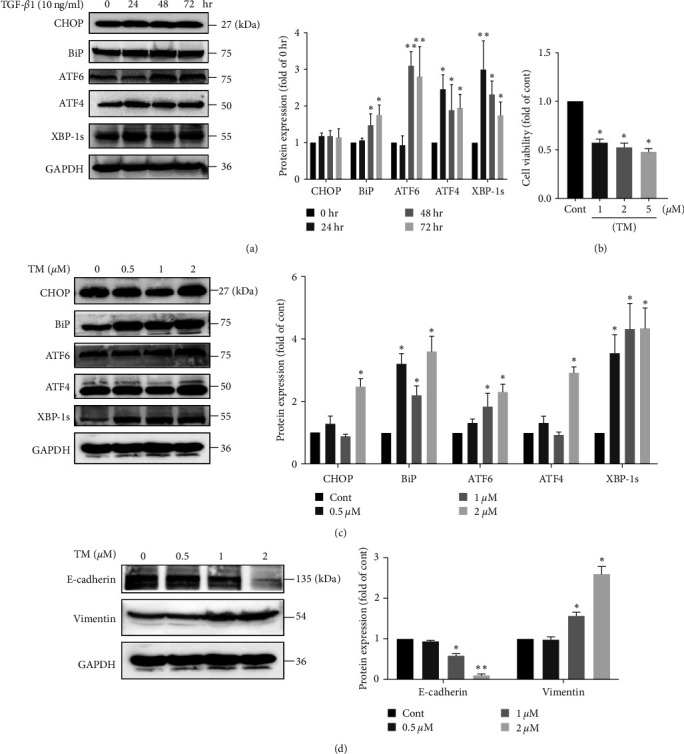 Mesenchymal Stem Cells Inhibit Epithelial-to-Mesenchymal Transition by Modulating the IRE1<i>α</i> Branch of the Endoplasmic Reticulum Stress Response.