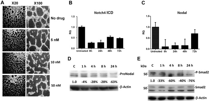 CVM-1118 (foslinanib), a 2-phenyl-4-quinolone derivative, promotes apoptosis and inhibits vasculogenic mimicry via targeting TRAP1.