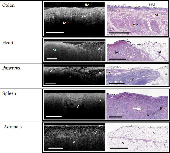 Wide-field optical coherence tomography for microstructural analysis of key tissue types: a proof-of-concept evaluation.