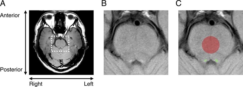 A possible contribution of the locus coeruleus to arousal enhancement with mild exercise: evidence from pupillometry and neuromelanin imaging.