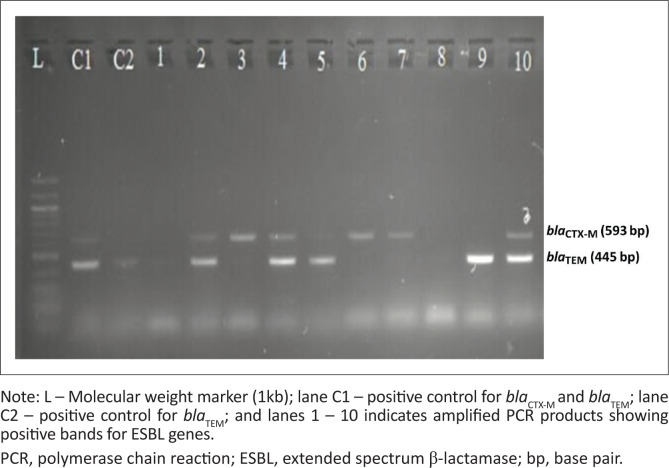 Characterisation of genes encoding for extended spectrum β-lactamase in Gram-negative bacteria causing healthcare-associated infections in Mwanza, Tanzania.