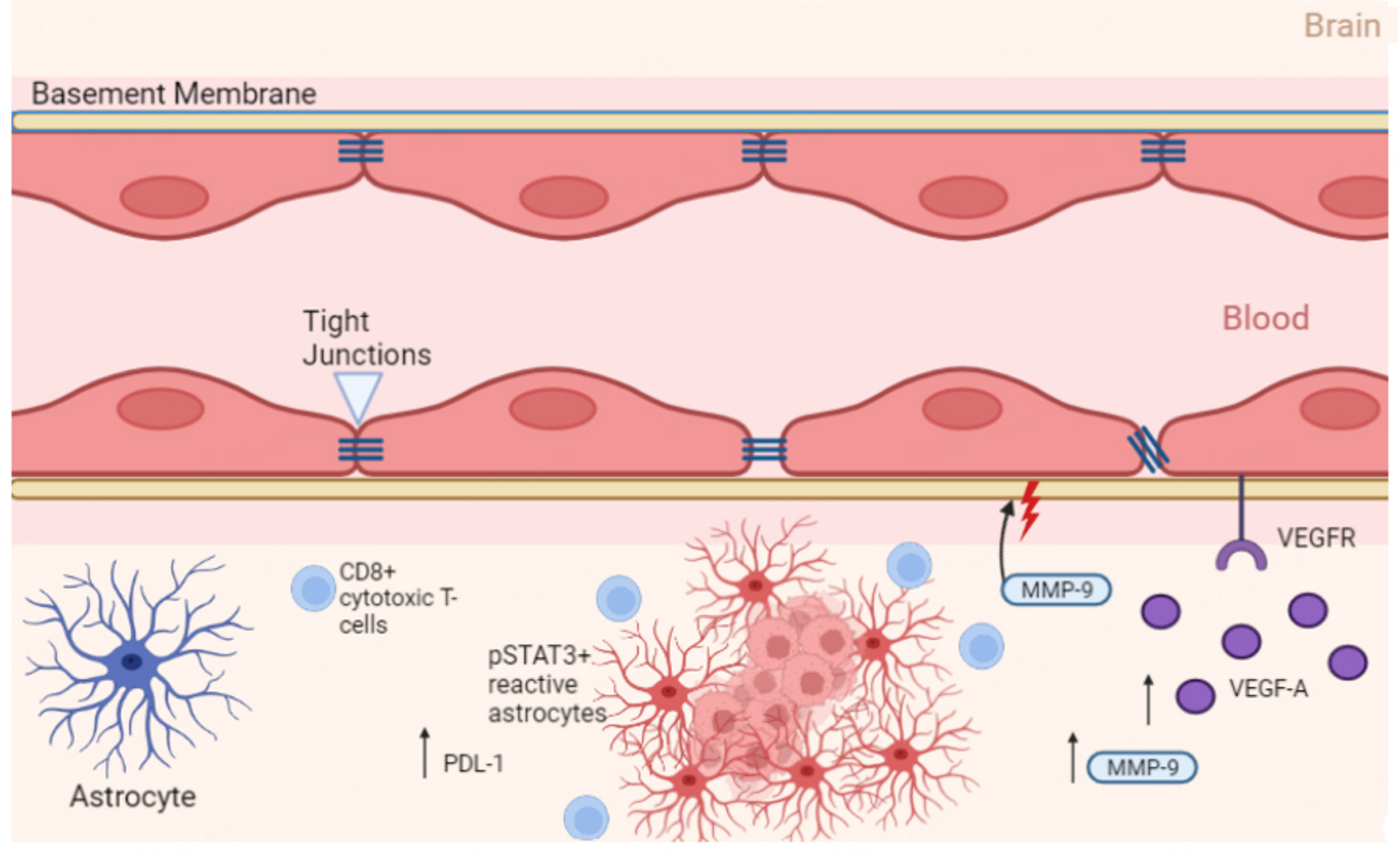 Advanced breast cancer metastasized in the brain: treatment standards and innovations.