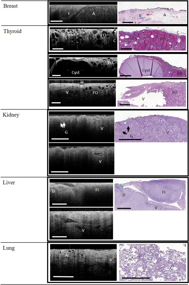 Wide-field optical coherence tomography for microstructural analysis of key tissue types: a proof-of-concept evaluation.