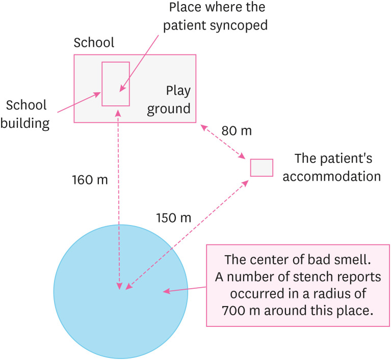 A case of syncope in a villager with hypertrophic cardiomyopathy after hydrogen sulfide exposure by an unauthorized discharge of wastewater.