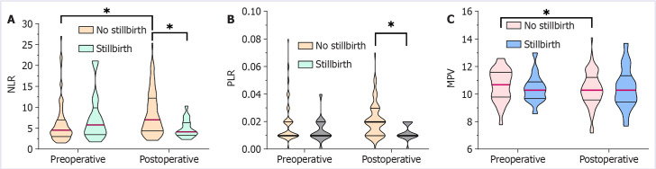 Value of hematological indices NLR, PLR, and MPV to determine the clinical outcome of placental abruption in women regarding stillbirth.