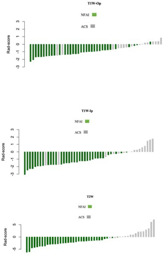 A radiomic signature based on magnetic resonance imaging to determine adrenal Cushing's syndrome.