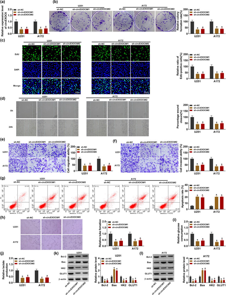 Knockdown of circEXOC6 inhibits cell progression and glycolysis by sponging miR-433-3p and mediating FZD6 in glioma.