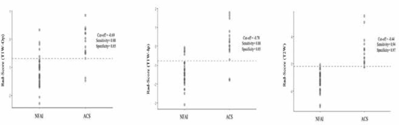 A radiomic signature based on magnetic resonance imaging to determine adrenal Cushing's syndrome.