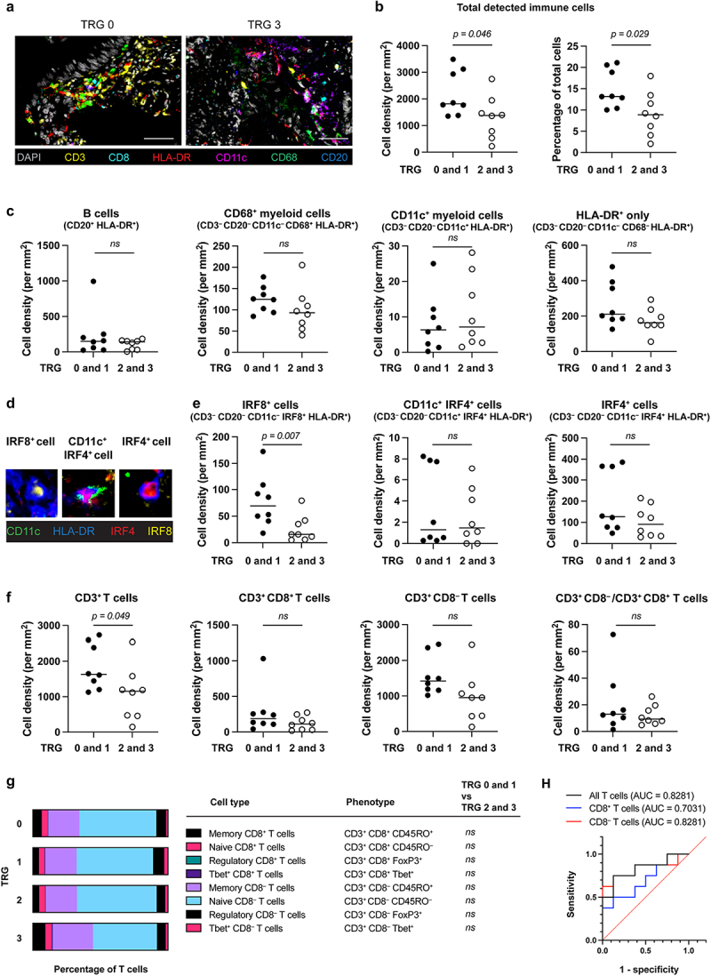 CD11c<sup>+</sup> and IRF8<sup>+</sup> cell densities in rectal cancer biopsies predict outcomes of neoadjuvant chemoradiotherapy.