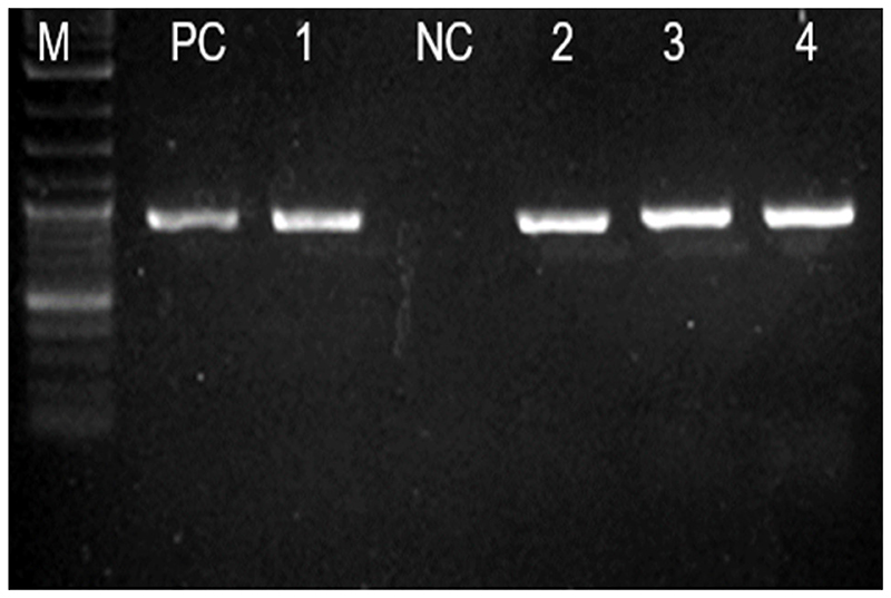 Comparison of Horizontal <i>bla<sub>CTX-M</sub></i> Gene Transfer via Conjugation among Extended Spectrum β-Lactamases Producing <i>Escherichia coli</i> Isolates from Patients with Urinary Tract Infection, Their Animals, and Environment.