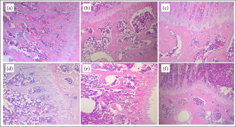 The mechanism study of inhibition effect of prepared Radix Rehmanniainon combined with Radix Astragali osteoporosis through PI3K-AKT signaling pathway.