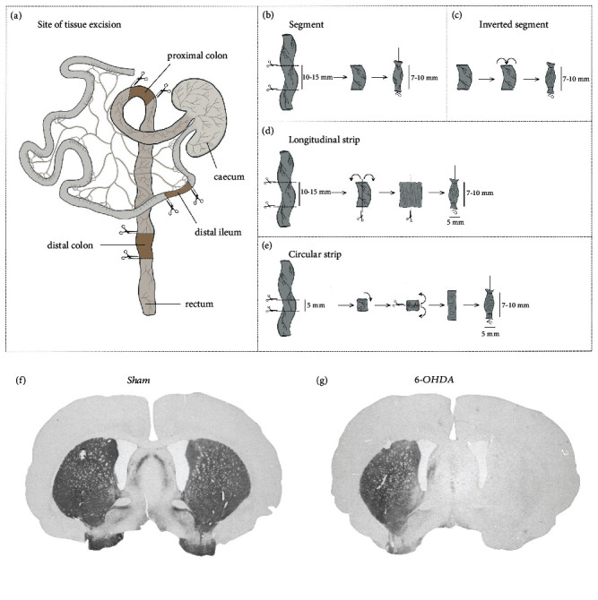 6-OHDA-Induced Changes in Colonic Segment Contractility in the Rat Model of Parkinson's Disease.