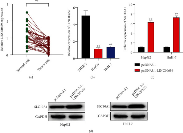 LINC00659 Inhibits Hepatocellular Carcinoma Malignant Progression by Blocking Aerobic Glycolysis through FUS Recruitment and SLC10A1 Modulation.