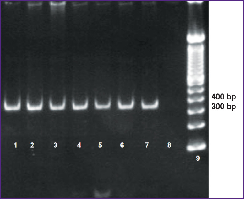 NGS Technology in Monitoring the Genetic Diversity of Cytomegalovirus Strains.