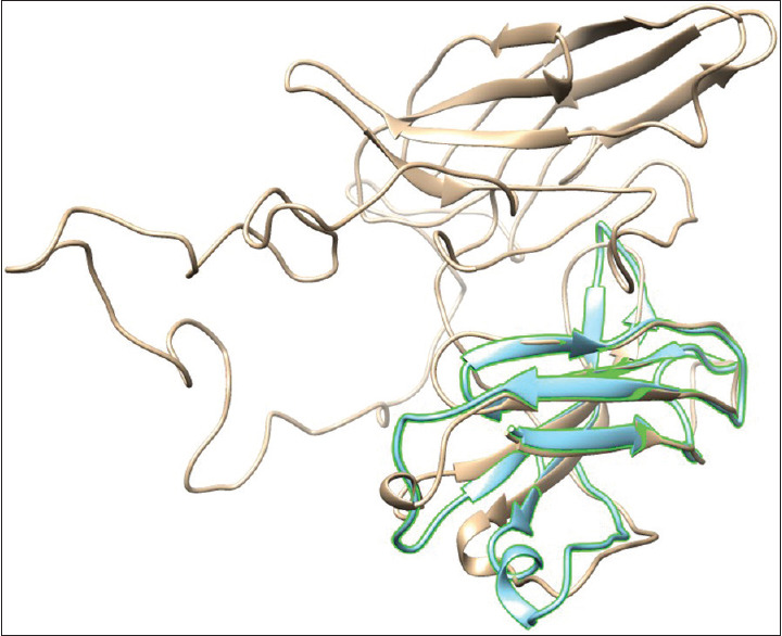 Limb-Girdle Muscular Dystrophy Type 2B (LGMD2B) caused by Pathogenic Splice and Missense Variants of <i>DYSF</i> Gene among Iranians with Muscular Dystrophy.