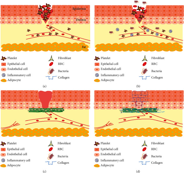 Multidrug-Resistant Pathogens in Burn Wound, Prevention, Diagnosis, and Therapeutic Approaches (Conventional Antimicrobials and Nanoparticles).