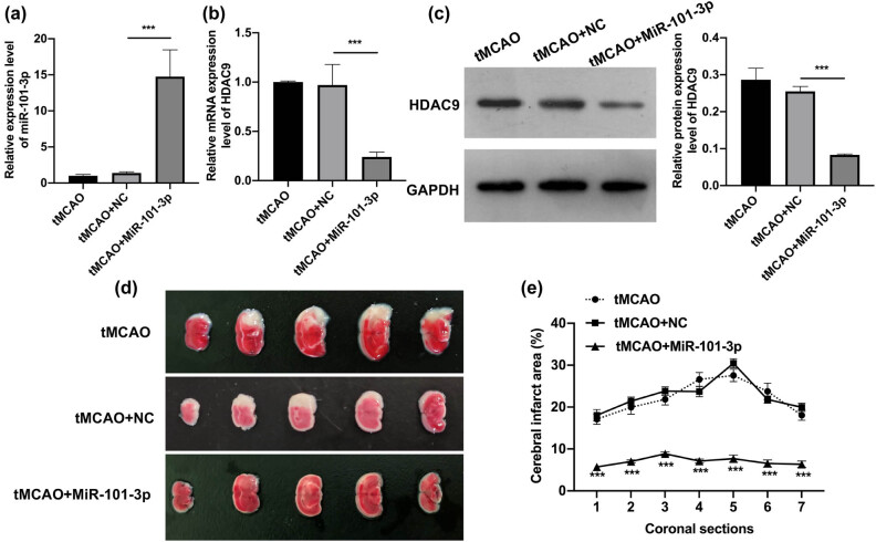 miR-101-3p improves neuronal morphology and attenuates neuronal apoptosis in ischemic stroke in young mice by downregulating HDAC9.