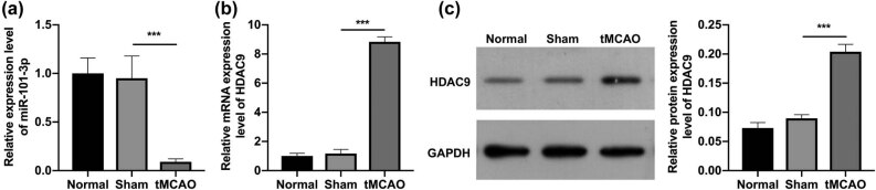 miR-101-3p improves neuronal morphology and attenuates neuronal apoptosis in ischemic stroke in young mice by downregulating HDAC9.