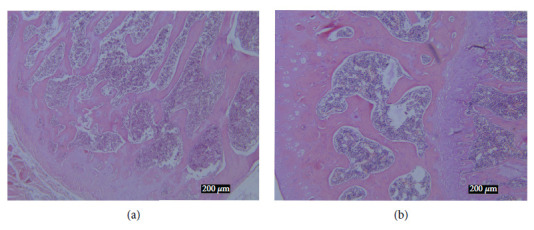 Comparative Pharmacokinetic Study of 5 Active Ingredients after Oral Administration of Zuogui Pill in Osteoporotic Rats with Different Syndrome Types.