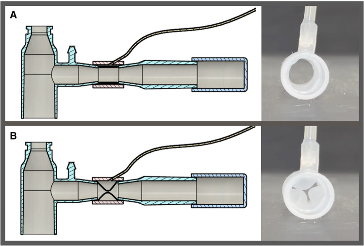 Proof-of-concept study of compartmentalized lung ventilation using system for asymmetric flow regulation (SAFR).