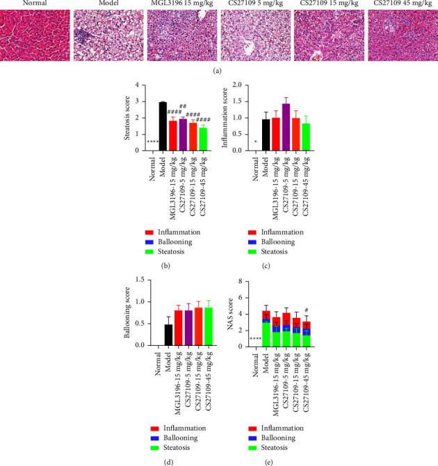 CS27109, A Selective Thyroid Hormone Receptor-<i>β</i> Agonist Alleviates Metabolic-Associated Fatty Liver Disease in Murine Models.