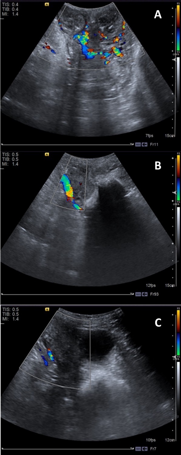 Characterization of uterine involution using B-mode ultrasonography, color Doppler and elastography (acoustic radiation force impulse) for assessing postpartum in Santa Inês ewes.