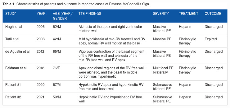 Reverse McConnell's: A Sign of Acute Pulmonary Embolism.