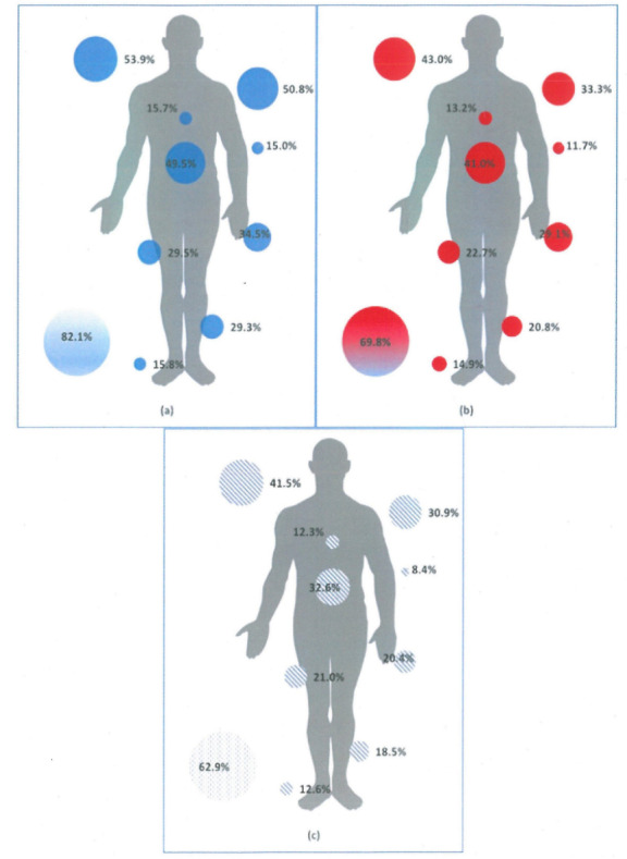 Stress and Prevalence of Musculoskeletal Disorders Among the Nursing Personnel of a Tertiary Hospital Unit in Greece: A Cross-Sectional Study.