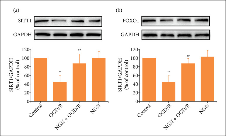 Naringenin attenuates cerebral ischemia/reperfusion injury by inhibiting oxidative stress and inflammatory response via the activation of SIRT1/FOXO1 signaling pathway in vitro.