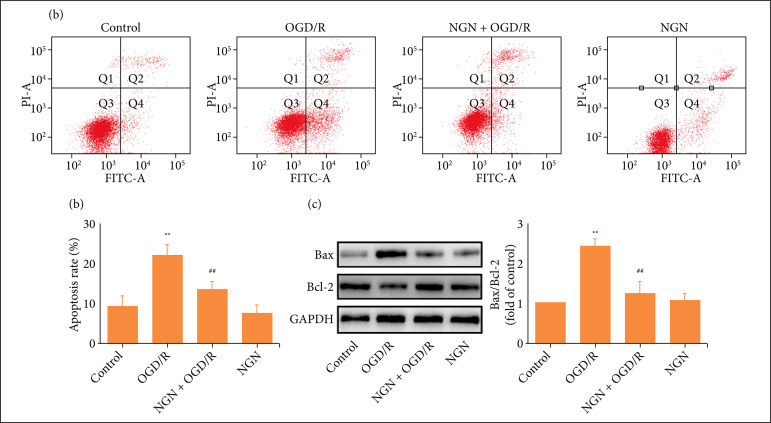 Naringenin attenuates cerebral ischemia/reperfusion injury by inhibiting oxidative stress and inflammatory response via the activation of SIRT1/FOXO1 signaling pathway in vitro.