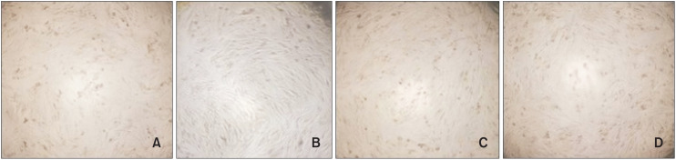 Evaluation of the cell viability and antimicrobial effects of orthodontic bands coated with silver or zinc oxide nanoparticles: An <i>in vitro</i> study.