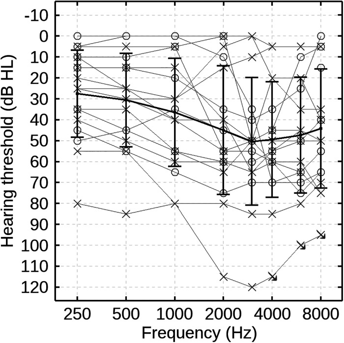 Predicting Hearing aid Benefit Using Speech-Evoked Envelope Following Responses in Children With Hearing Loss.