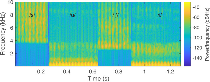 Predicting Hearing aid Benefit Using Speech-Evoked Envelope Following Responses in Children With Hearing Loss.