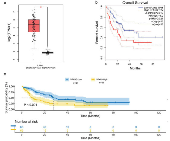 SFXN3 is Associated with Poor Clinical Outcomes and Sensitivity to the Hypomethylating Therapy in Non-M3 Acute Myeloid Leukemia Patients.