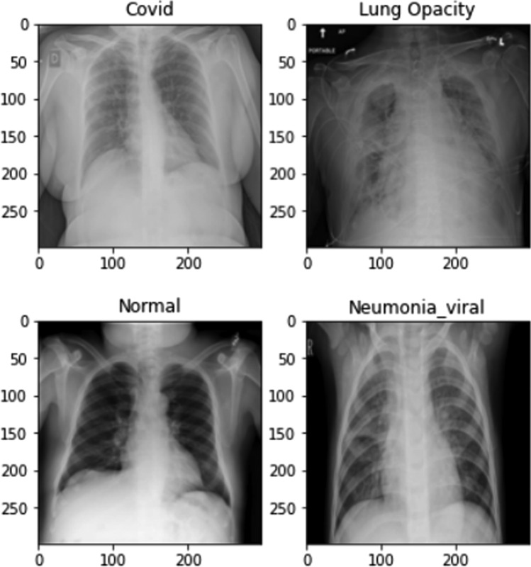 Evaluating deep learning predictions for COVID-19 from X-ray images using leave-one-out predictive densities.