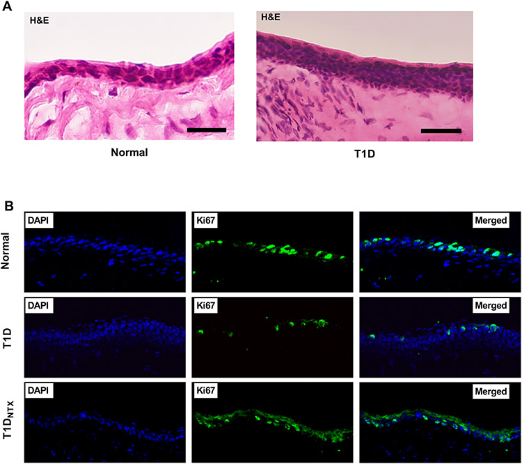 Elevated Opioid Growth Factor Alters the Limbus in Type 1 Diabetic Rats.